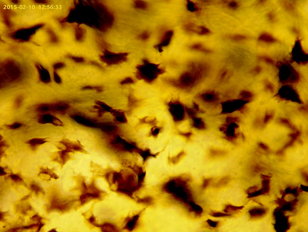 Melanocytes in frog skin | Nikon’s Small World