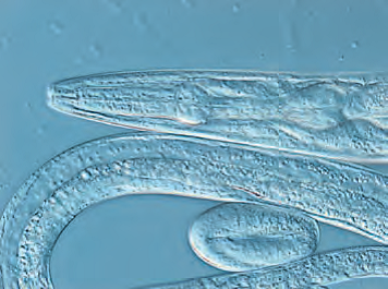 不同微分干涉(DIC) 棱镜位置下记录的线虫