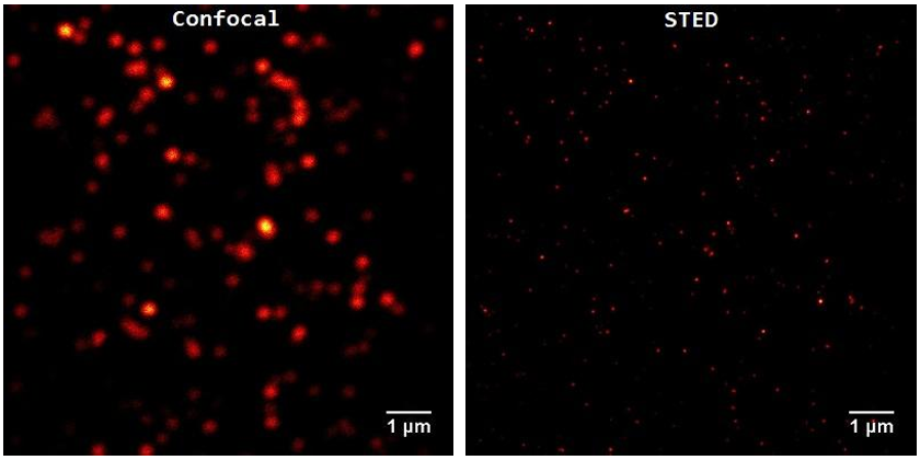 共焦显微镜和STED显微镜获得的成像对比1