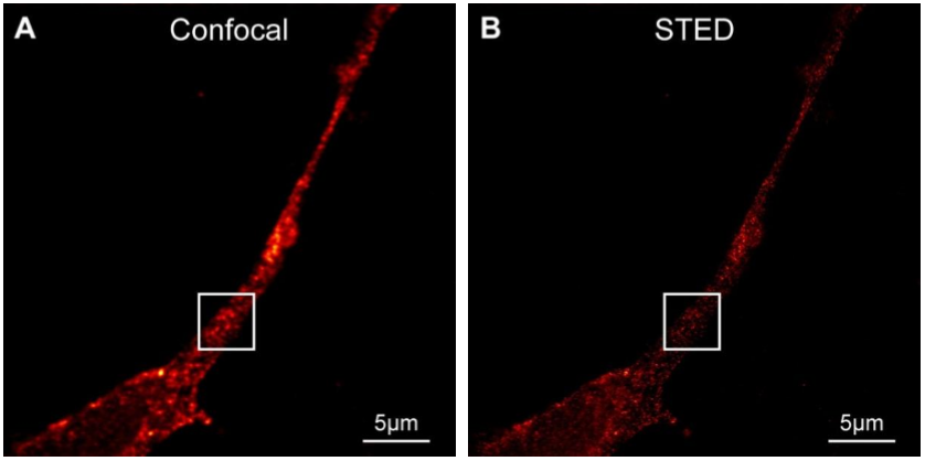 共焦显微镜和STED显微镜获得的成像对比2