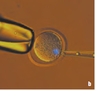 小鼠卵子染色体移动顺序(紫外线和透射光)： b 吸入移动吸液管