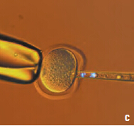 小鼠卵子染色体移动顺序(紫外线和透射光)：c 移动