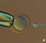 小鼠卵子染色体移动顺序(紫外线和透射光)：d 移动的结果