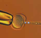 小鼠卵子染色体移动顺序（紫外荧光和透射光）c移动