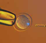 小鼠卵子染色体移动顺序（紫外荧光和透射光）A移动前