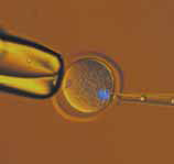 小鼠卵子染色体移动顺序（紫外荧光和透射光）b吸入移动吸液管