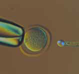 小鼠卵子染色体移动顺序（紫外荧光和透射光）d移动的验证
